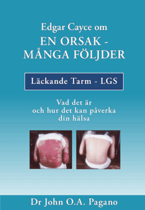 bokforside Edgar Cayce om En orsak - Många följder
